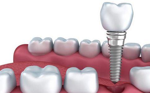 缺牙修复怕疼怎么办?